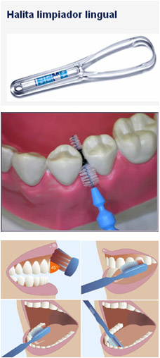 Tratamiento-halitosis.jpg