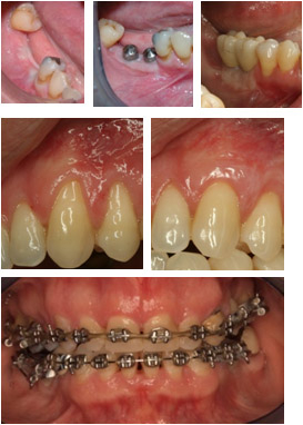 Fase-restauracion-1.jpg