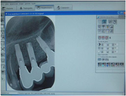 sistema-radiologia-digital-2